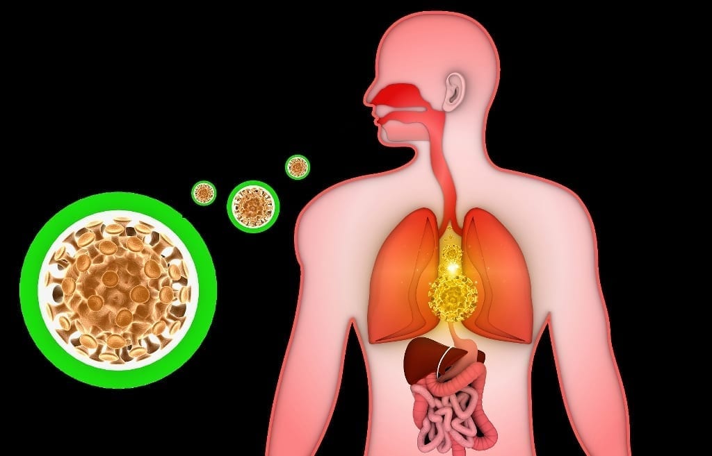 Image of chronic lung inflammation