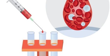 Jack Andraka, test to detect pancreatic, ovarian and lung cancer