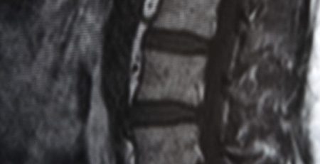 Internal Image of the spine