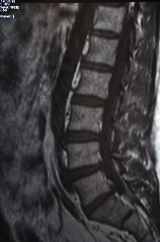 Internal Image of the spine