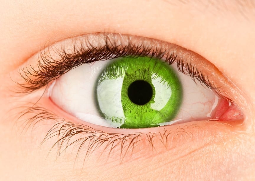 Stroma Medical has come up with a technique that allows you to change your eye color