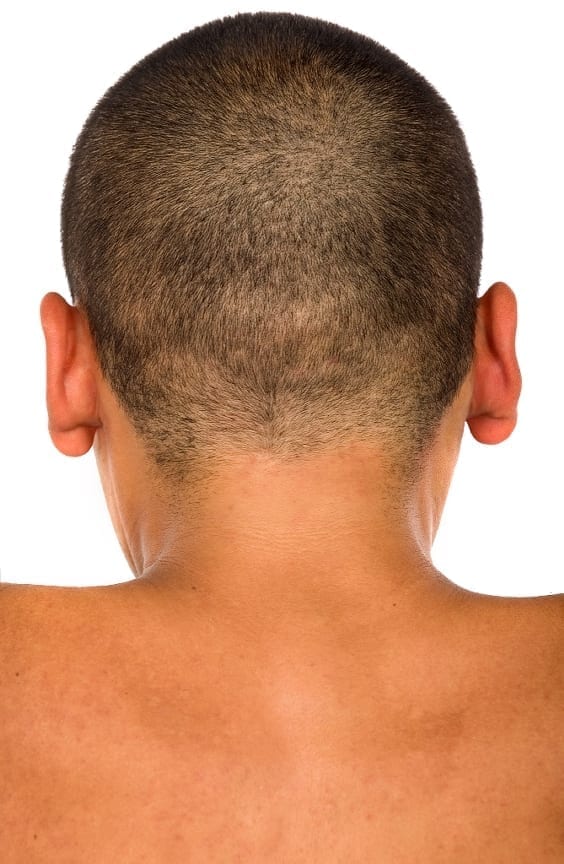 Boy gets ears made from his ribs - The Lab World Group Boy gets ears made from his ribs - The Lab World Group