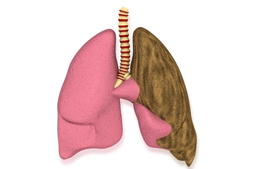 Climavax is the first ever lung cancer vaccine, and it has been launched by Cuba