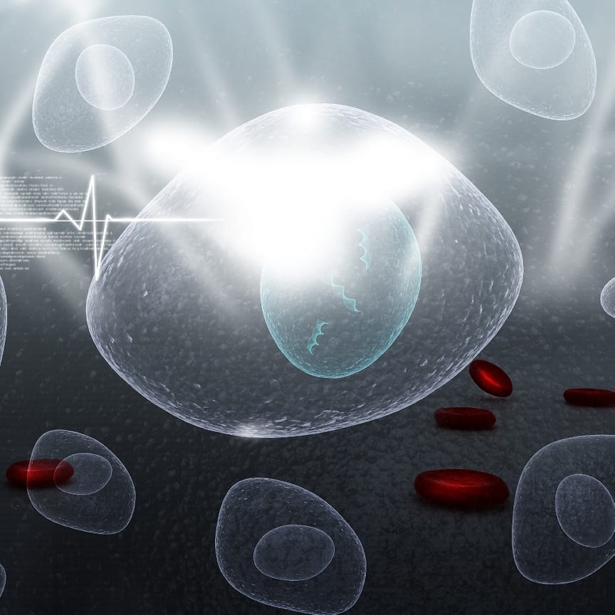 Stem Cell Therapy being offered to Multiple Sclerosis Patients