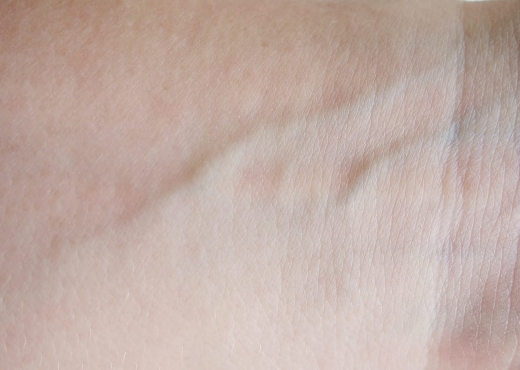 Lab Grows Super Realistic Skin Graphs