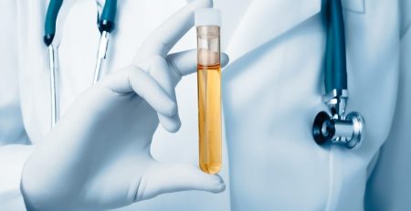 Biomarker found in urine could assist in determining an individual's biological age