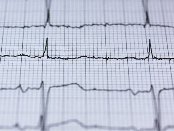 A new study in Sweden has found that the odds of having a heart attack increase by nearly 40% on Christmas Eve.